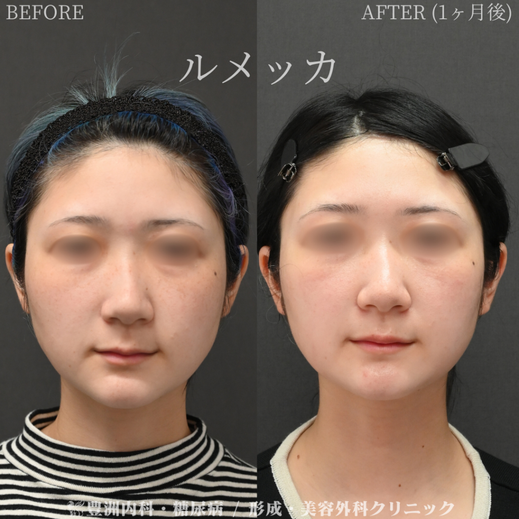 ルメッカ / 20代女性